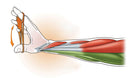 Finger Extender